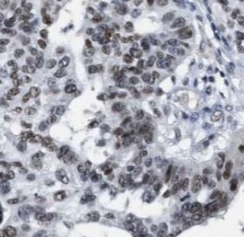 PPARD Rabbit Polyclonal Antibody