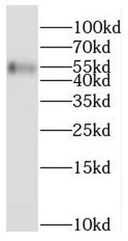 PPAT Rabbit Polyclonal Antibody