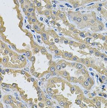 PPID Rabbit Polyclonal Antibody