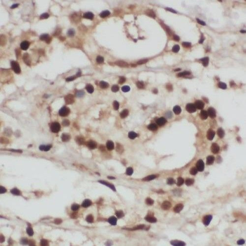 PPIG Rabbit Polyclonal Antibody