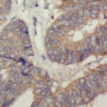 PPIH Rabbit Polyclonal Antibody