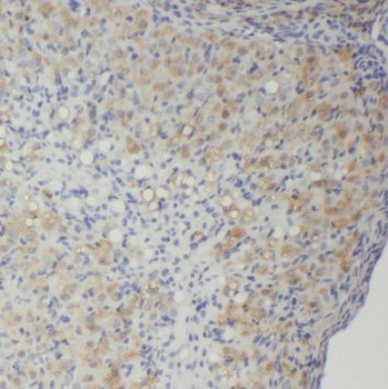 PPIL3 Rabbit Polyclonal Antibody