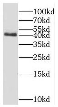 PPM1A Rabbit Polyclonal Antibody