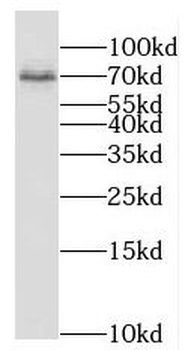 PPM1G Antibody