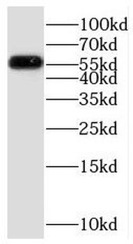 PDP1 Rabbit Polyclonal Antibody