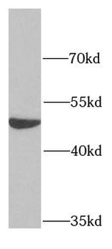 PPOX Rabbit Polyclonal Antibody