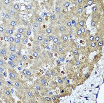 PPOX Rabbit Polyclonal Antibody