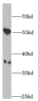 PPP1CB Rabbit Polyclonal Antibody