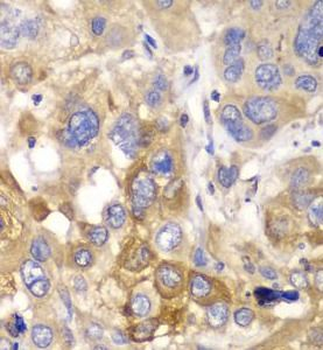 PPP1CB Rabbit Polyclonal Antibody