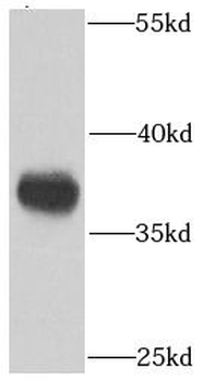 PPP1CC Rabbit Polyclonal Antibody