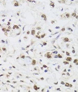 PPP1CC Rabbit Polyclonal Antibody