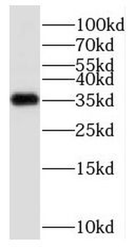 PPP1CC Rabbit Polyclonal Antibody