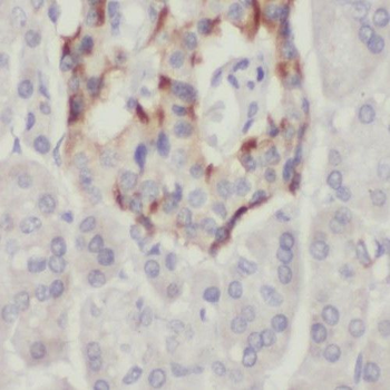 PPP1CC Rabbit Polyclonal Antibody