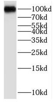 PPP1R10 Antibody
