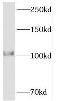 PPP1R15B Rabbit Polyclonal Antibody