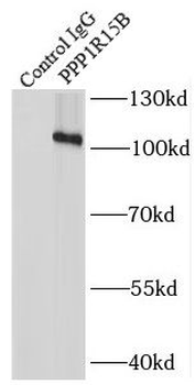 PPP1R15B Rabbit Polyclonal Antibody