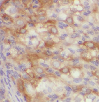 PPP1R15B Rabbit Polyclonal Antibody
