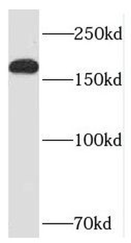 PPP1R9A Rabbit Polyclonal Antibody