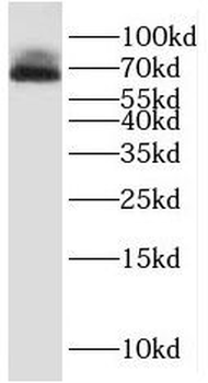 PPP2R1A Rabbit Polyclonal Antibody
