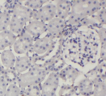 PPP2R1A Rabbit Polyclonal Antibody