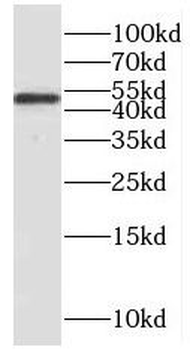 PPP2R2C Rabbit Polyclonal Antibody