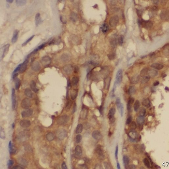 PPP2R2C Rabbit Polyclonal Antibody