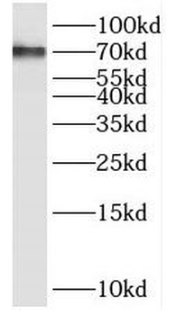 PPP2R5D Rabbit Polyclonal Antibody