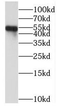PPP2R5E Rabbit Polyclonal Antibody