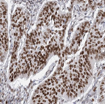PPP2R5E Rabbit Polyclonal Antibody