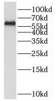 PPP3CB Antibody