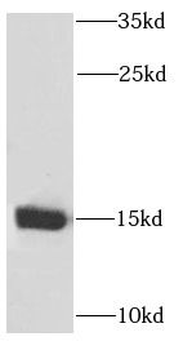 PPP3R1 Antibody