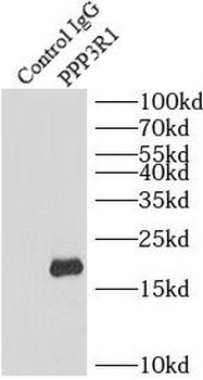 PPP3R1 Antibody