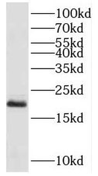 PPP3R2 Rabbit Polyclonal Antibody