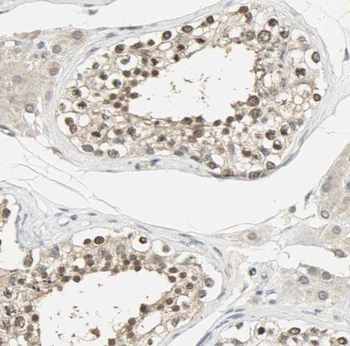 PPP3R2 Rabbit Polyclonal Antibody