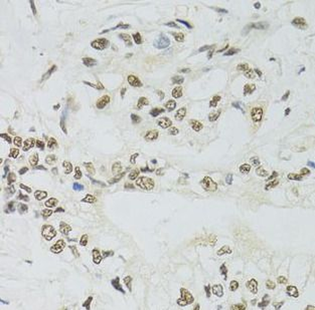 PPP4C Rabbit Polyclonal Antibody