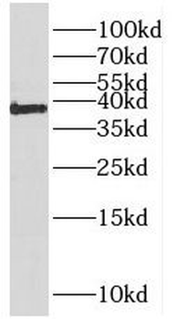 PQBP1 Rabbit Polyclonal Antibody
