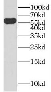 PRAME Rabbit Polyclonal Antibody
