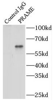 PRAME Rabbit Polyclonal Antibody