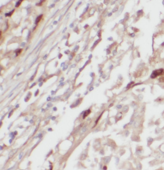 PRCP Rabbit Polyclonal Antibody