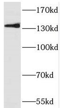 PRDM10 Rabbit Polyclonal Antibody