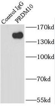 PRDM10 Rabbit Polyclonal Antibody
