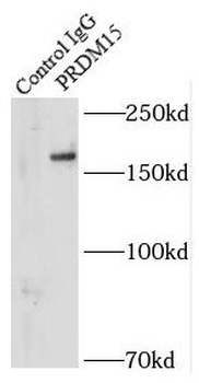 PRDM15 Rabbit Polyclonal Antibody