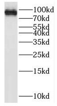 PRDM4 Rabbit Polyclonal Antibody