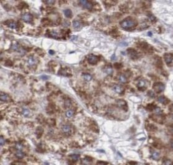 TTR Rabbit Polyclonal Antibody
