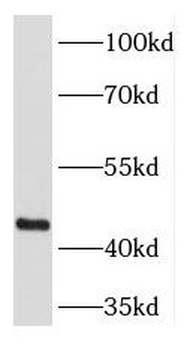 PREB Rabbit Polyclonal Antibody