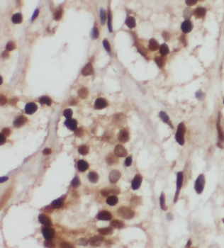 PREB Rabbit Polyclonal Antibody