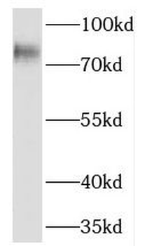 PREP Rabbit Polyclonal Antibody