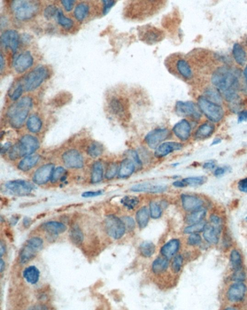 PREP Rabbit Polyclonal Antibody