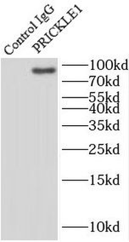 PRICKLE1 Rabbit Polyclonal Antibody
