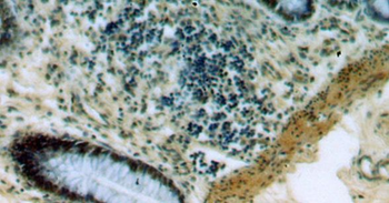 PRICKLE3 Rabbit Polyclonal Antibody